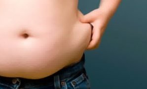 obesitas
